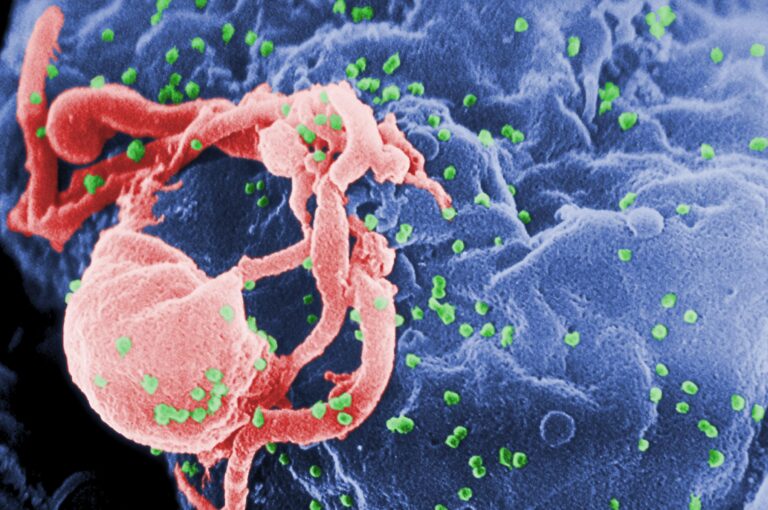 HIV/AIDS in Estonia