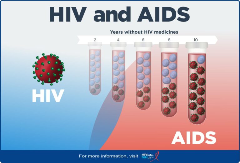 Addressing HIV/AIDS in Kazakhstan